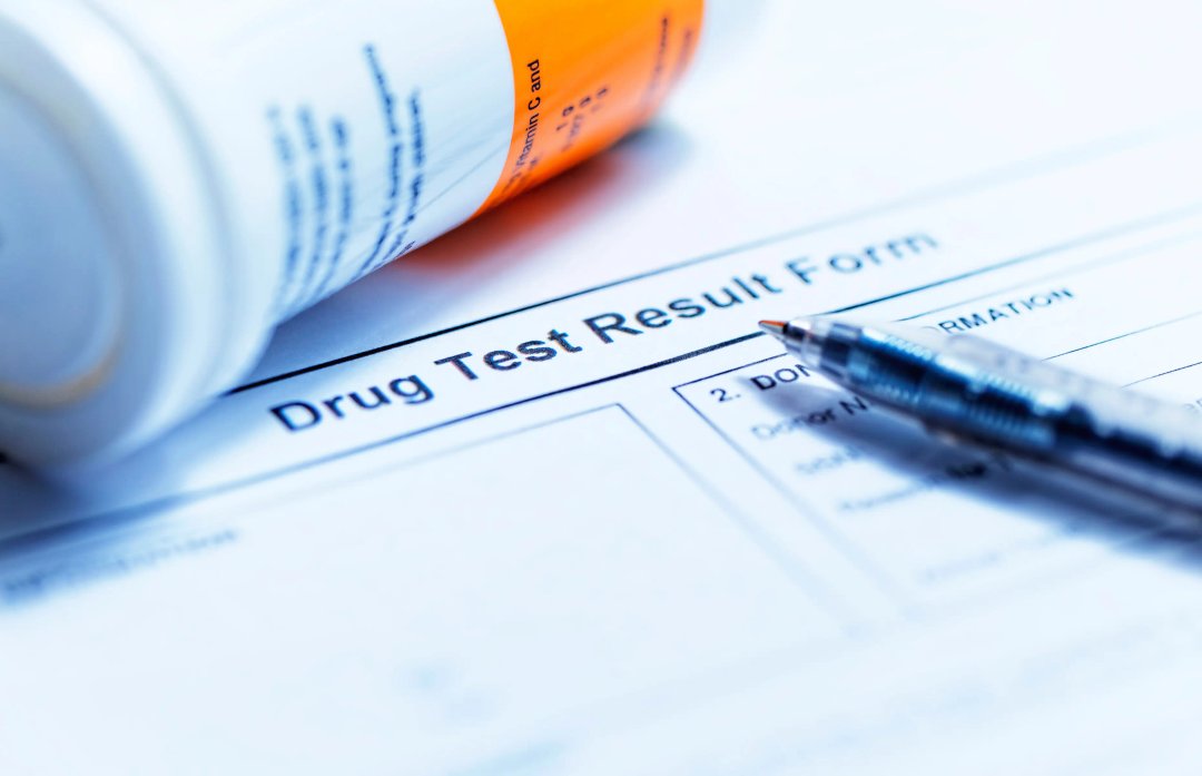 drug test form closeup