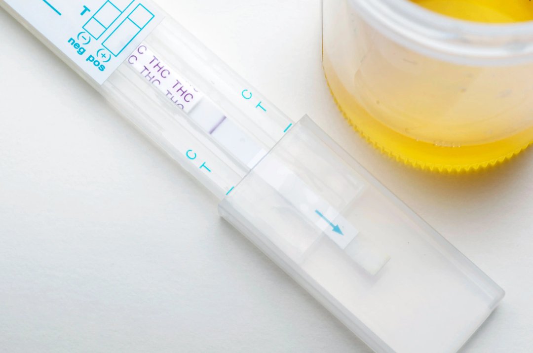 drug test showing thc detection results